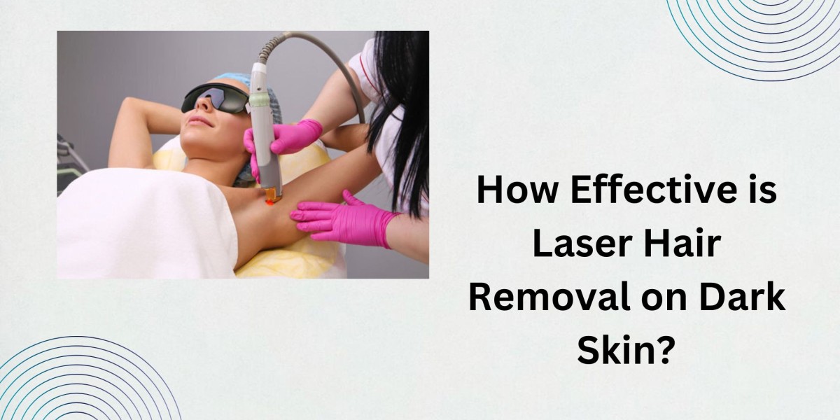 How Effective is Laser Hair Removal on Dark Skin?