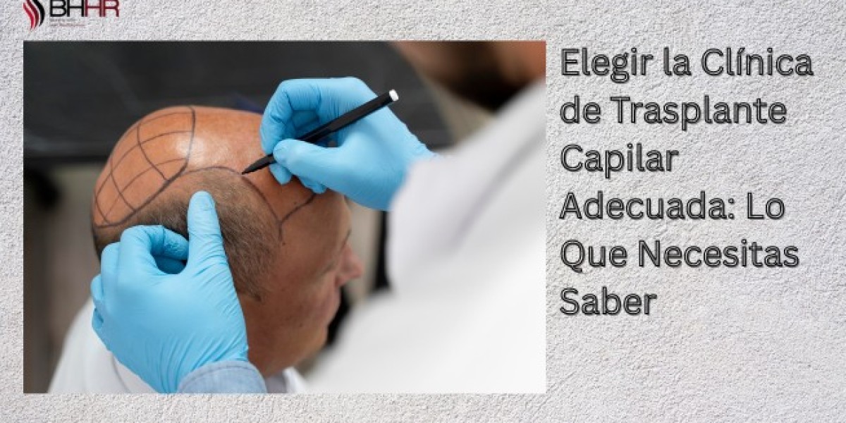 Elegir la Clínica de Trasplante Capilar Adecuada: Lo Que Necesitas Saber