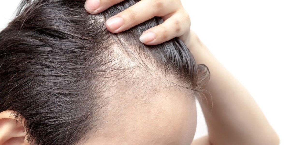 Alopecia Market Size, Share, Trends & Forecast 2034