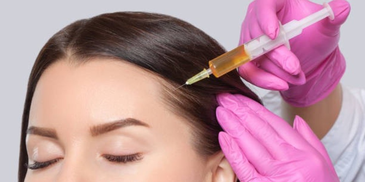 Discovering PRP Hair Treatment as a Key to Stronger Follicle Health