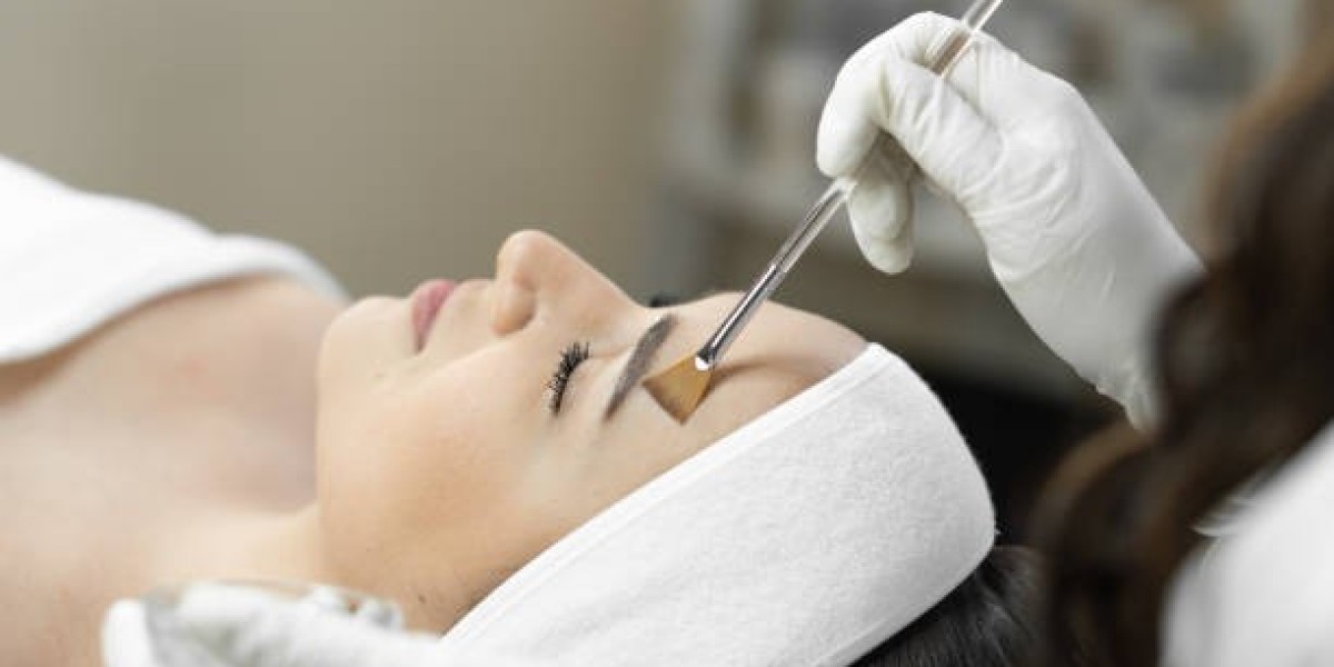 Chemical Peels: Your Path to Smoother Skin