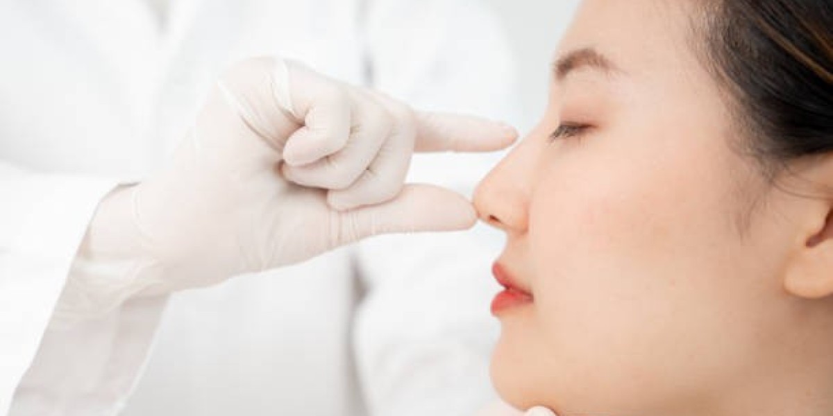 Rhinoplasty for Improving Facial Balance Naturally
