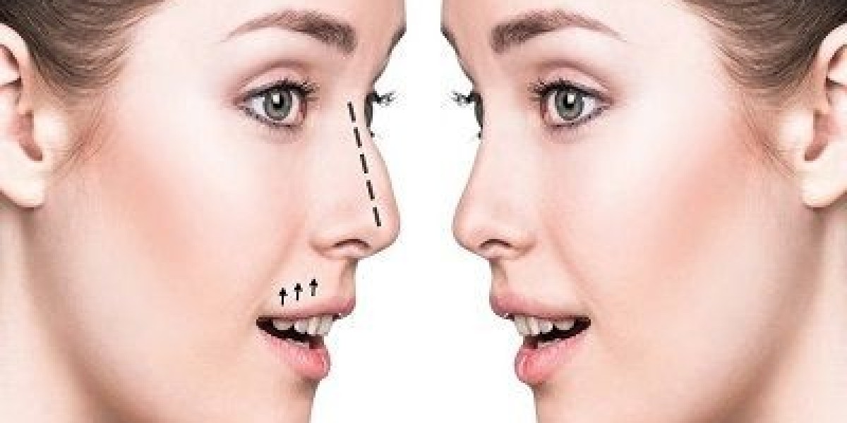 Enhancing Symmetry: Nose Surgery in Islamabad