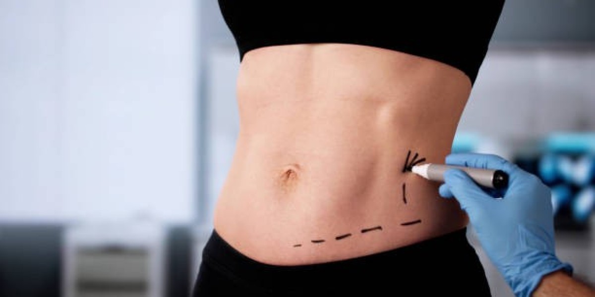 How Does Liposuction Procedure Work Step by Step?