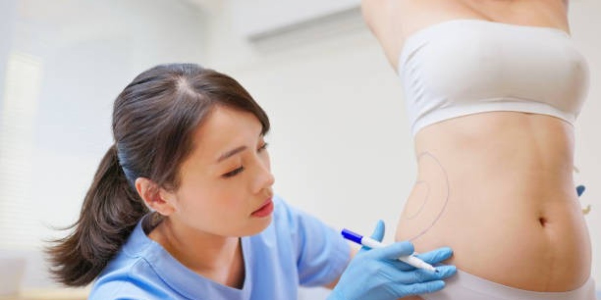 What Bruising Normal Fractional Liposuction?