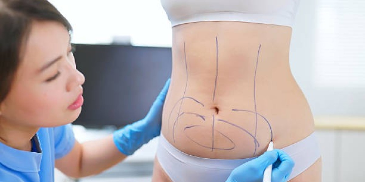 Does Liposuction Procedure Accent Ribs?
