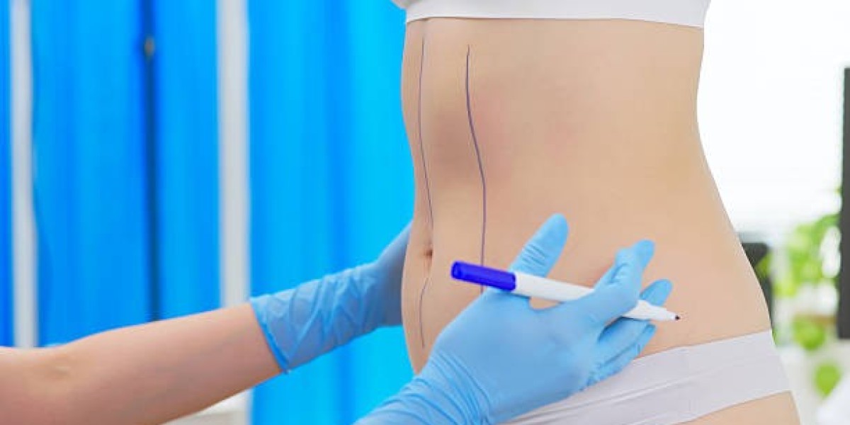 What Aspiration Techniques in Liposuction Procedure?