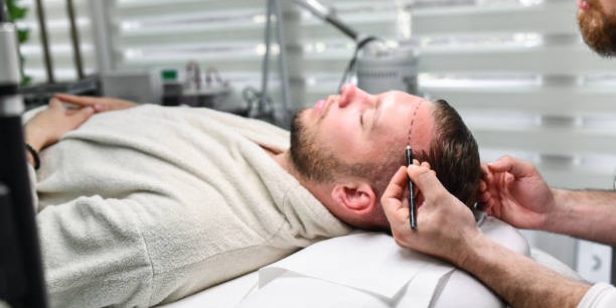 FUT Hair Transplant in Dubai: Scalp Laxity Requirements