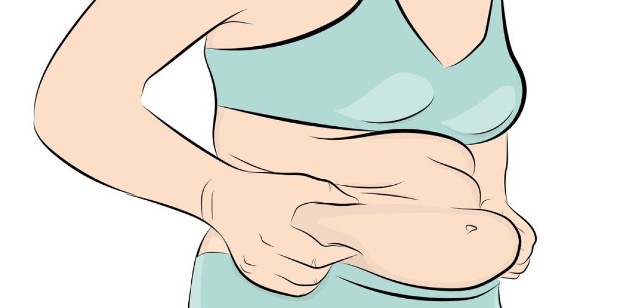 Achieve a Toned Midsection with Abdominoplasty in Islamabad